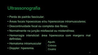 Ultrassonografia
22
• Perda do padrão fascicular;
• Áreas focais hipoecoicas e/ou hiperecoicas intramusculares;
• Descontinuidade focal ou completa das fibras;
• Normalmente na junção miofascial ou miotendínea;
• Hemorragia intersticial: área hiperecoica com margens mal
definidas;
• Hematoma intramuscular
• Doppler: hiperemia.
Agudo
Crônico
Cicatriz
 