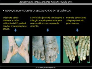 Incapacidade para as ocupações habituais, por mais de 30 dias;