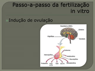 Indução de ovulação
 