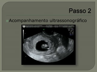 Acompanhamento ultrassonográfico
 