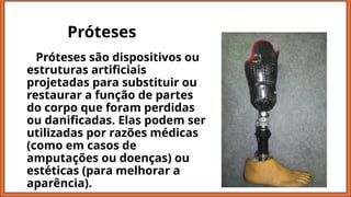 Próteses
Próteses são dispositivos ou
estruturas artificiais
projetadas para substituir ou
restaurar a função de partes
do corpo que foram perdidas
ou danificadas. Elas podem ser
utilizadas por razões médicas
(como em casos de
amputações ou doenças) ou
estéticas (para melhorar a
aparência).
 
