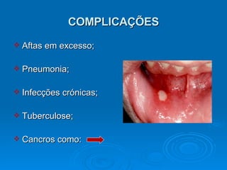 COMPLICAÇÕES Aftas em excesso; Pneumonia; Infecções crónicas; Tuberculose; Cancros como:  