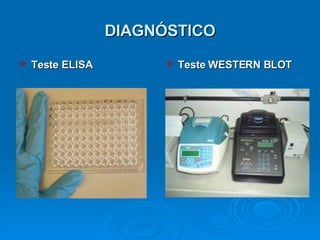 DIAGNÓSTICO Teste ELISA Teste WESTERN BLOT 