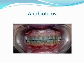 Antibióticos
 
