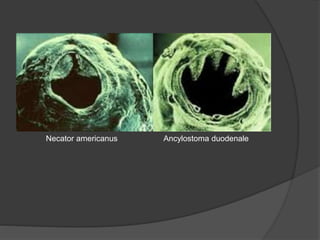 Necator americanus Ancylostoma duodenale
 