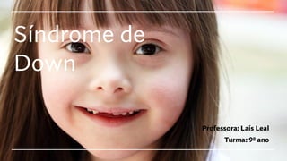 Síndrome de
Down
Professora: Laís Leal
Turma: 9º ano
 