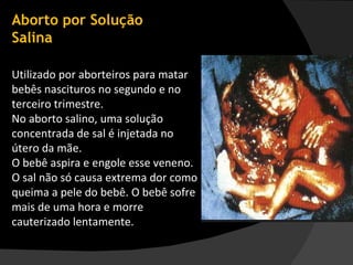 Aborto por Solução Salina Utilizado por aborteiros para matar bebês nascituros no segundo e no terceiro trimestre.  No aborto salino, uma solução concentrada de sal é injetada no útero da mãe.  O bebê aspira e engole esse veneno. O sal não só causa extrema dor como  queima a pele do bebê. O bebê sofre mais de uma hora e morre cauterizado lentamente. 
