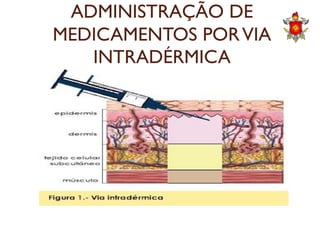 ADMINISTRAÇÃO DE
MEDICAMENTOS PORVIA
INTRADÉRMICA
 