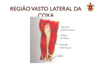 REGIÃOVASTO LATERAL DA
COXA
 