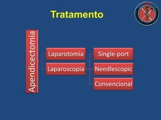 Apendicectomia
Laparotomia
Laparoscopia
Single-port
Needlescopic
Convencional
Tratamento
 