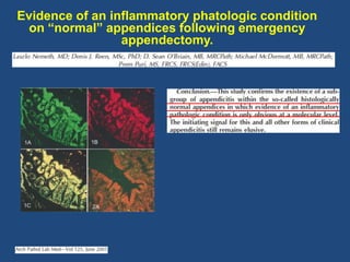 Evidence of an inflammatory phatologic condition
on “normal” appendices following emergency
appendectomy.
 