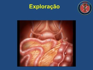 Exploração
 