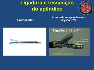 Ligadura e ressecção
do apêndice
Grampeador
Sistema de selagem de vasos
(LigaSureTM)
 