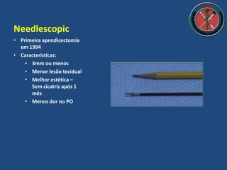 Needlescopic
• Primeira apendicectomia
em 1994
• Caracteristicas:
• 3mm ou menos
• Menor lesão tecidual
• Melhor estética –
Sem cicatriz após 1
mês
• Menos dor no PO
 