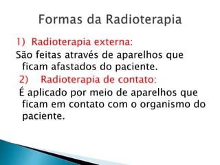 1) Radioterapia externa:
São feitas através de aparelhos que
ficam afastados do paciente.
2) Radioterapia de contato:
É aplicado por meio de aparelhos que
ficam em contato com o organismo do
paciente.
 