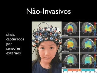 Não-Invasivos

sinais
capturados
por
sensores
externos
 