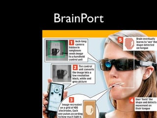BrainPort
 