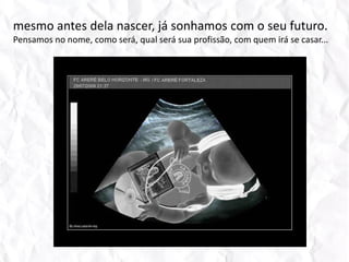 mesmo antes dela nascer, já sonhamos com o seu futuro. Pensamos no nome, como será, qual será sua profissão, com quem irá se casar...  