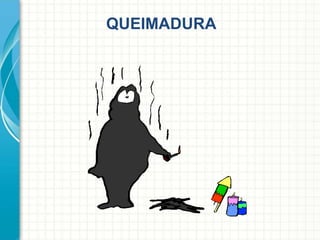 QUEIMADURA
 