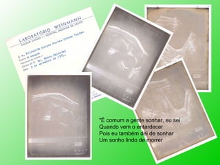 "É comum a gente sonhar, eu sei Quando vem o entardecer Pois eu também dei de sonhar Um sonho lindo de morrer 