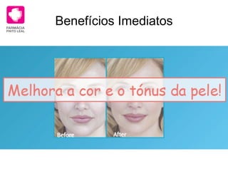 Benefícios Imediatos 