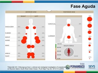 Fase Aguda 
Thiberville S-D. Chikungunya fever: a clinical and virological investigation of outpatients 
on Reunion Island, South-West Indian Ocean. PLoS Negl Trop Dis. 2013;7(1):e2004. 
 