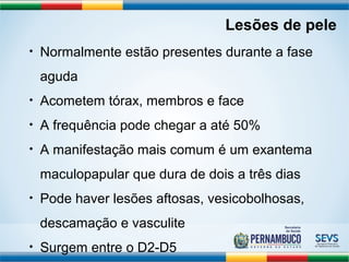 Lesões de pele 
• Normalmente estão presentes durante a fase 
aguda 
• Acometem tórax, membros e face 
• A frequência pode chegar a até 50% 
• A manifestação mais comum é um exantema 
maculopapular que dura de dois a três dias 
• Pode haver lesões aftosas, vesicobolhosas, 
descamação e vasculite 
• Surgem entre o D2-D5 
 