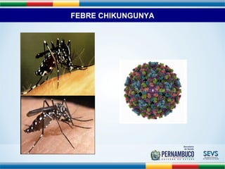 FEBRE CHIKUNGUNYA 
 
