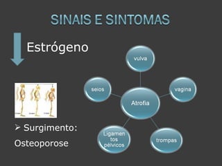 Estrógeno




 Surgimento:
Osteoporose
 