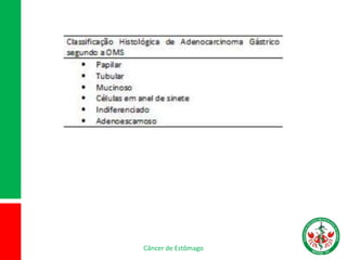 Câncer de Estômago
 