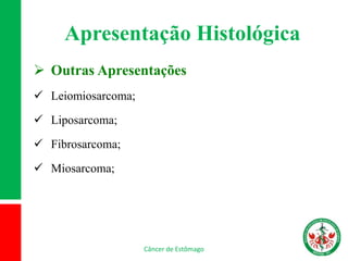 Apresentação Histológica
 Outras Apresentações
 Leiomiosarcoma;
 Liposarcoma;
 Fibrosarcoma;
 Miosarcoma;
Câncer de Estômago
 