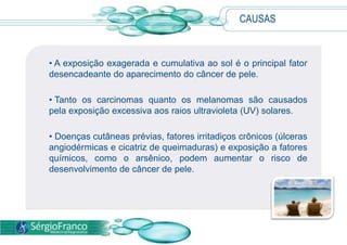 Indivíduos de pele clara são as principais vítimas.INTRODUÇÃO Como a pele é um órgão heterogêneo, esse tipo de câncer pode apresentar neoplasias de diferentes linhagens. Os mais frequentessão: 