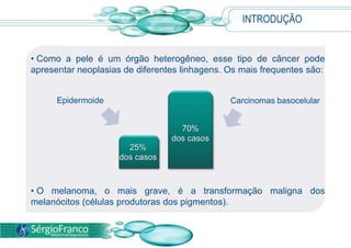 INTRODUÇÃO
• Como a pele é um órgão heterogêneo, esse tipo de câncer pode
apresentar neoplasias de diferentes linhagens. Os mais frequentes são:
• O melanoma, o mais grave, é a transformação maligna dos
melanócitos (células produtoras dos pigmentos).
Carcinomas basocelularEpidermoide
70%
dos casos
25%
dos casos
 