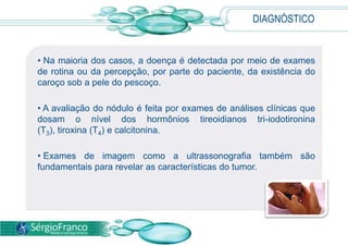  O câncer de tireóide ocorre quando alterações genéticas permitem que as células cresçam e se multipliquem rapidamente.