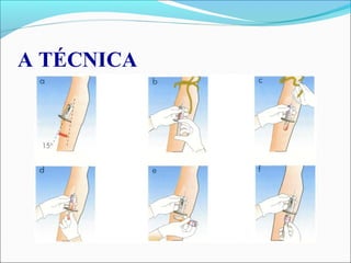 A TÉCNICA
 