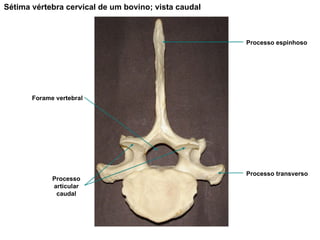 Sétima vértebra cervical de um bovino; vista caudal Processo espinhoso Processo articular caudal Processo transverso Forame vertebral 