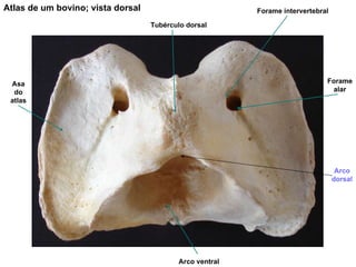 Atlas de um bovino; vista dorsal Tubérculo dorsal Forame intervertebral Asa do atlas Arco ventral Forame alar Arco dorsal 