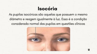 Isocória
As pupilas isocóricas são aquelas que possuem o mesmo
diâmetro e reagem igualmente à luz. Essa é a condição
considerada normal das pupilas em questões clínicas
12
 