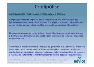 Criolipólise
COMPROVAÇÕES CIÊNTIFICAS QUE EMBASARAM A TÉCNICA:
A exposição do tecido adiposo a baixas temperaturas leva à cristalização dos 
lipídios encontrados dentro do citoplasma dos adipócitos, levando à inviabilidade 
dessas células, as quais são destruídas, e gerando um processo inflamatório., q , g p
Os danos provocados ao tecido adiposo são significativamente mais extensos comOs danos provocados ao tecido adiposo são significativamente mais extensos com 
a diminuição da temperatura alcançada e com o aumento do tempo de exposição 
do tecido ao frio. 
Além disso, o processo que leva à redução da gordura se inicia através da exposição 
d id b i é i d ó A ido tecido a baixas temperaturas, e é continuado após o tratamento. Assim, os 
resultados mais expressivas são observadas após determinado período de tempo, e 
a resposta ao tratamento se mantém crescente mesmo depois de alguns meses.
BRIAN ZELICKSON, et al. Cryolipolysis for Noninvasive Fat Cell Destruction: Initial 
Results from a Pig Model. American Society for Dermatologic Surgery , 2009.
 