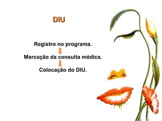 DIU Registro no programa. Marcação da consulta médica. Colocação do DIU. 
