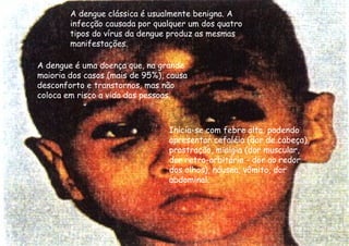 A dengue clássica é usualmente benigna. A infecção causada por qualquer um dos quatro tipos do vírus da dengue produz as mesmas manifestações.  A dengue é uma doença que, na grande maioria dos casos (mais de 95%), causa desconforto e transtornos, mas não coloca em risco a vida das pessoas.  Inicia-se com febre alta, podendo apresentar cefaléia (dor de cabeça), prostração, mialgia (dor muscular, dor retro-orbitária - dor ao redor dos olhos), náusea, vômito, dor abdominal.  