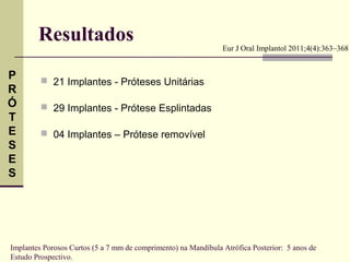 Resultados                                              Eur J Oral Implantol 2011;4(4):363–368


P         21 Implantes - Próteses Unitárias
R
Ó         29 Implantes - Prótese Esplintadas
T
E         04 Implantes – Prótese removível
S
E
S




Implantes Porosos Curtos (5 a 7 mm de comprimento) na Mandíbula Atrófica Posterior: 5 anos de
Estudo Prospectivo.
 