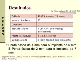 Resultados                                              Eur J Oral Implantol 2011;4(4):363–368



R
E
S
U
M
O


     Perda óssea de 1 mm para o Implante de 5 mm
        & Perda óssea de 2 mm para o Implante de 7
        mm.
Implantes Porosos Curtos (5 a 7 mm de comprimento) na Mandíbula Atrófica Posterior: 5 anos de
Estudo Prospectivo.
 