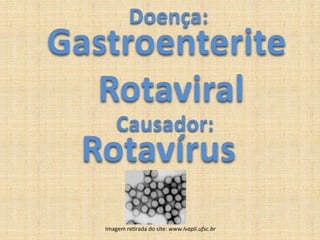 Doença:GastroenteriteRotaviralCausador:RotavírusImagem retirada do site: www.lvapli.ufsc.br