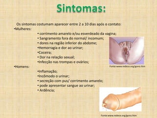 Sintomas:   Os sintomas costumam aparecer entre 2 a 10 dias após o contato:Mulheres: 