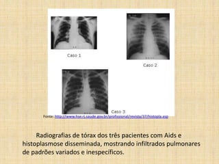 ContágioO Antraz é natural em regiões agrícolas onde existem animais herbívoros, domésticos ou selvagens. O homem é um hospedeiro acidental, sendo que esta doença é mais comum em agricultores e veterinários.
