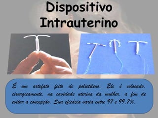 Dispositivo
           Intrauterino



É um artefato feito de polietileno. Ele é colocado,
cirurgicamente, na cavidade uterina da mulher, a fim de
evitar a concepção. Sua eficácia varia entre 97 e 99,7%.
 