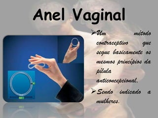 Anel Vaginal
       Um             método
        contraceptivo     que
        segue basicamente os
        mesmos princípios da
        pílula
        anticoncepcional,
       Sendo indicado a
        mulheres.
 