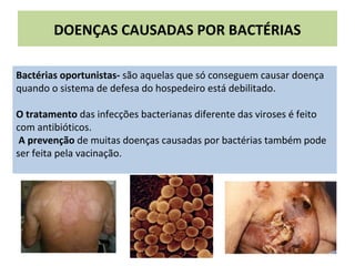 DOENÇAS CAUSADAS POR BACTÉRIAS
Bactérias oportunistas- são aquelas que só conseguem causar doença
quando o sistema de defesa do hospedeiro está debilitado.
O tratamento das infecções bacterianas diferente das viroses é feito
com antibióticos.
A prevenção de muitas doenças causadas por bactérias também pode
ser feita pela vacinação.
 