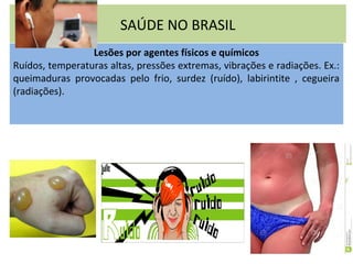 SAÚDE NO BRASIL
Lesões por agentes físicos e químicos
Ruídos, temperaturas altas, pressões extremas, vibrações e radiações. Ex.:
queimaduras provocadas pelo frio, surdez (ruído), labirintite , cegueira
(radiações).
 